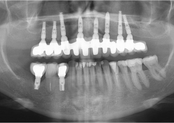 Raio x final - Clínica Cliniface