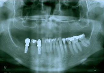 Raio x inicial - Clínica Cliniface