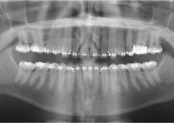 Raio x inicial - Clínica Cliniface