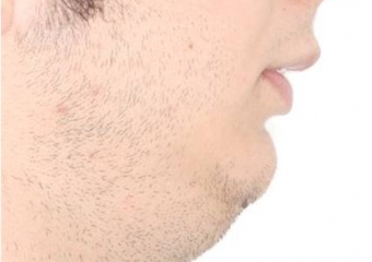 Perfil inicial - Clínica Cliniface