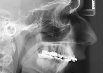 Telerradiografia inicial - Clínica Cliniface