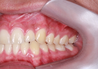 com tratamento ortodôntico finalizado  - Clínica Cliniface