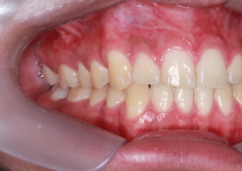 com tratamento ortodôntico finalizado  - Clínica Cliniface