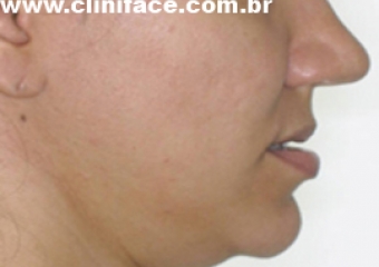 Imagem perfil inicial - Clínica Cliniface