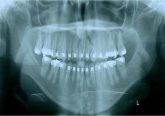 Rx inicial - Clínica Cliniface