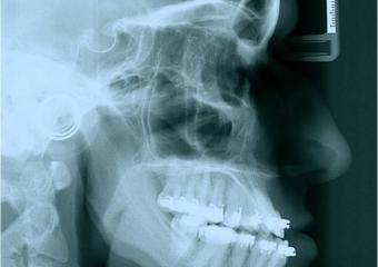 Telerradiografia inicial - Clínica Cliniface