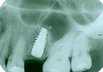   - Clínica Cliniface