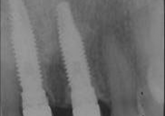 Raio X final - Clínica Cliniface