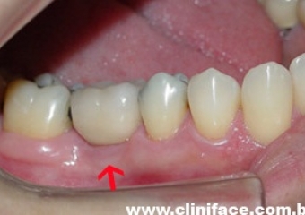  - Clínica Cliniface