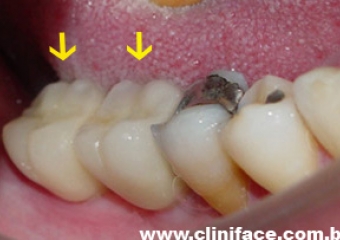  - Clínica Cliniface