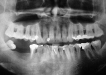 Raio X inicial - Clínica Cliniface