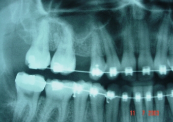 Raio X inicial - Clínica Cliniface