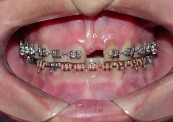  - Clínica Cliniface