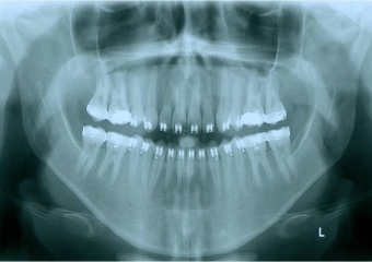 Raio x inicial - Clínica Cliniface