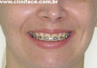 Imagem inicial frontal - Clínica Cliniface