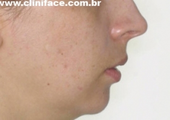 Perfil inicial - Clínica Cliniface