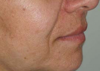 Imagem perfil final - Clínica Cliniface