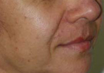 Imagem perfil inicial - Clínica Cliniface