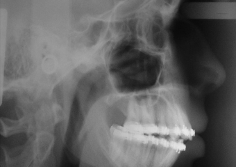 Telerradiografia inicial - Clínica Cliniface