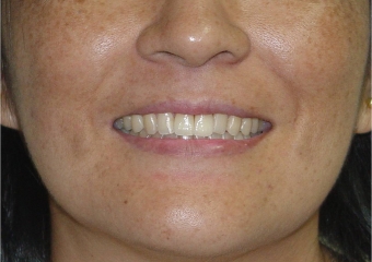 Sorriso - Clínica Cliniface