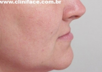 Perfil inicial - Clínica Cliniface