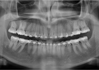 Raio X inicial - Clínica Cliniface
