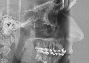 Telerradiografia após cirurgia - Clínica Cliniface