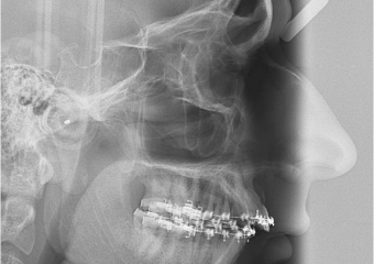 Telerradiografia inicial - Clínica Cliniface
