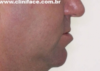 Perfil inicial - Clínica Cliniface