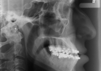 Telerradiografia inicial - Clínica Cliniface