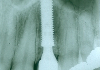 Raio X final - Clínica Cliniface