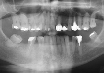 Raio X inicial - Clínica Cliniface