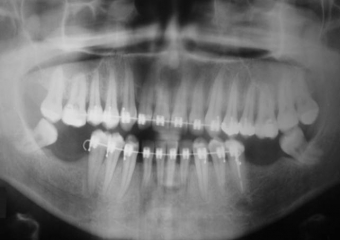 Raio X inicial - Clínica Cliniface