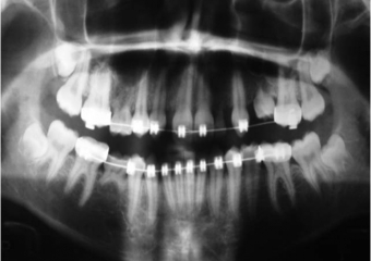 Raio X inicial - Clínica Cliniface