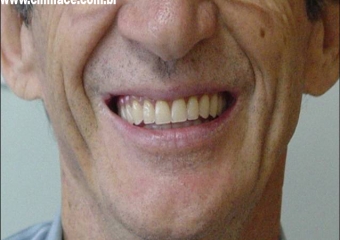 Sorriso final - Clínica Cliniface