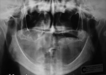 Raio X inicial - Clínica Cliniface