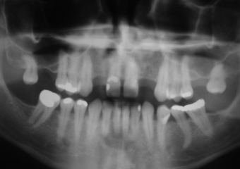 Raio X inicial - Clínica Cliniface
