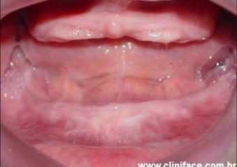 Imagens iniciais - Clínica Cliniface