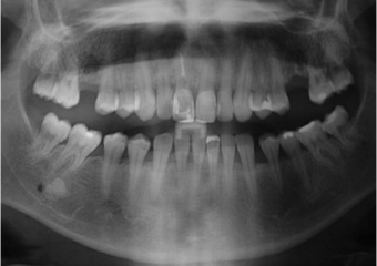 Raio X inicial - Clínica Cliniface