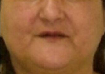 Imagens iniciais - Clínica Cliniface