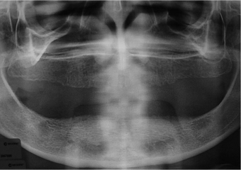 Raio X inicial - Clínica Cliniface