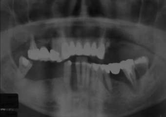 Raio X inicial - Clínica Cliniface