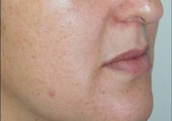 Imagem perfil inicial - Clínica Cliniface