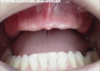 Imagem inicial intra oral - Clínica Cliniface