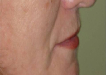 Imagem final - Clínica Cliniface