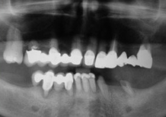 Raio X inicial - Clínica Cliniface