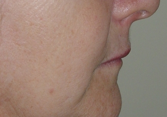 Imagem perfil final - Clínica Cliniface