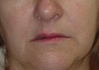 Imagem inicial - Clínica Cliniface