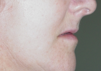 Imagem perfil inicial - Clínica Cliniface