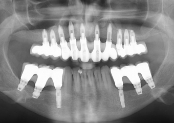 Raio X final - Clínica Cliniface
